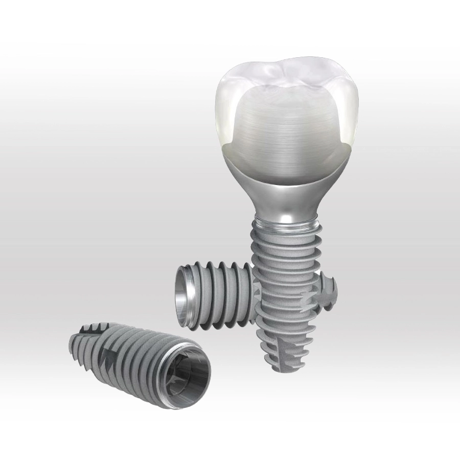 Cấy Ghép Implant