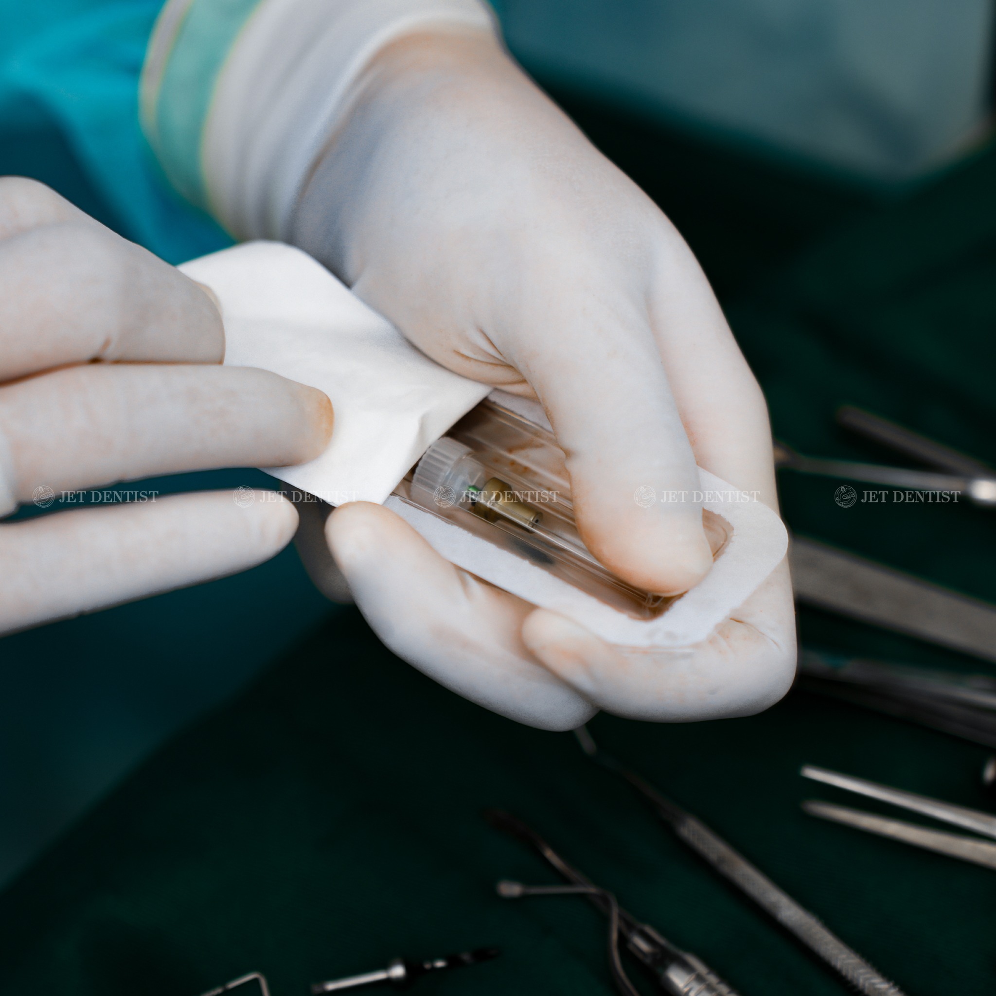 Cấy ghép Implant là giải pháp phục hình răng mất hiệu quả