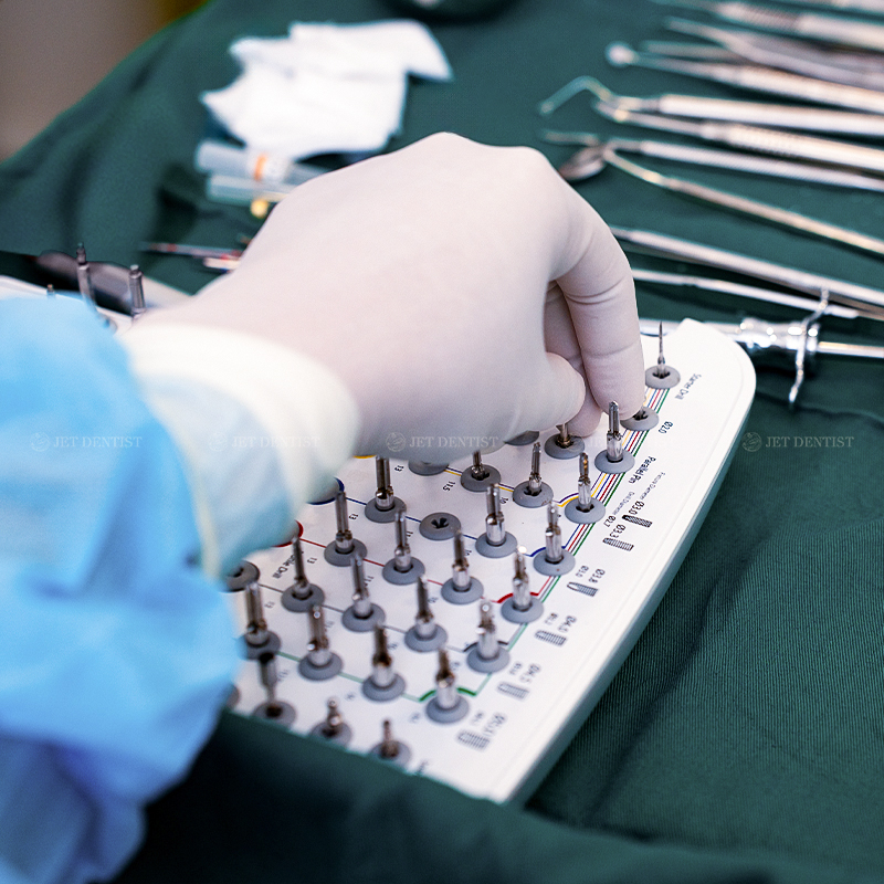 Có nhiều nguyên nhân có thể khiến cấy ghép Implant không thành công