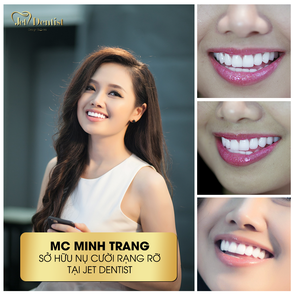 MC Minh Trang sở hữu nụ cười rạng rỡ tại Jet Dentist