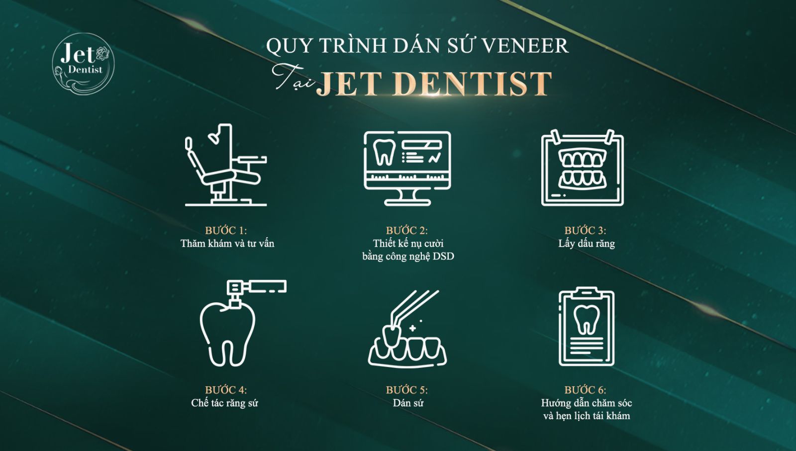 quy-trinh-dan-su-veneer-tai-jet-dentist