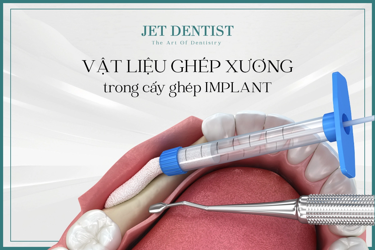 VẬT LIỆU GHÉP XƯƠNG TRONG CẤY GHÉP IMPLANT