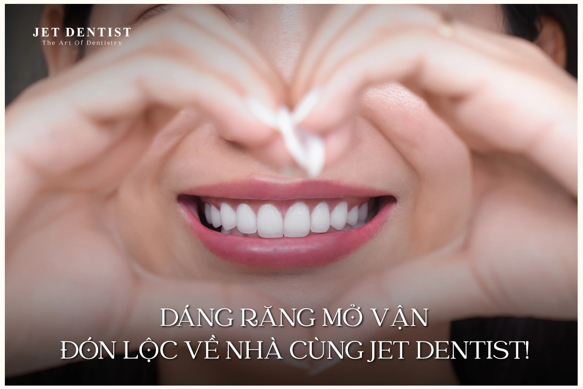 DÁNG RĂNG MỞ VẬN - ĐÓN LỘC VỀ NHÀ CÙNG JET DENTIST!