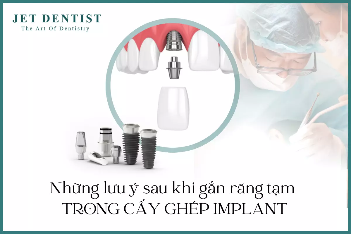 NHỮNG LƯU Ý SAU KHI GẮN RĂNG TẠM TRONG CẤY GHÉP IMPLANT