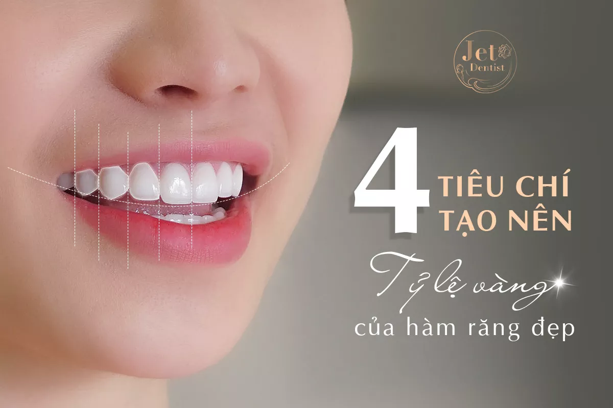 4 tiêu chí tạo nên tỷ lệ vàng của hàm răng đẹp